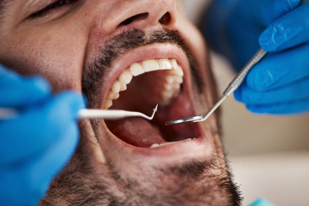 Best Emergency Gum Treatment in Green Forest, AR