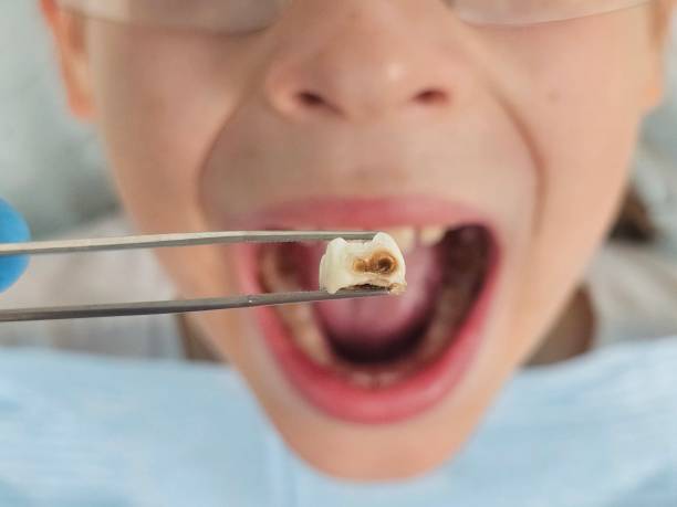 Best Same-Day Emergency Dental Services in Green Forest, AR